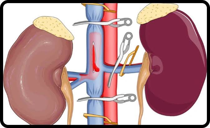 Dr. Avinash Singh Kidney Specialist Agra